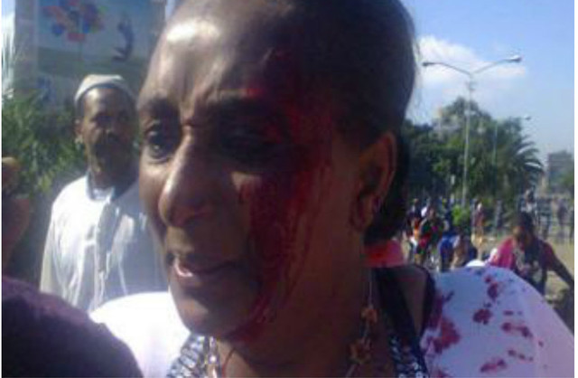 Rights Group Presses Ethiopia to End Crackdown at Muslim Demonstrations